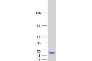 Validation with Western Blot