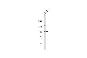 Anti-Ptk7 Antibody (C-term) at 1:1000 dilution + C2C12 whole cell lysate Lysates/proteins at 20 μg per lane.