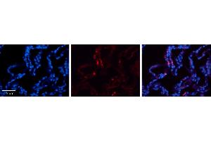 Rabbit Anti-CRIP2 Antibody     Formalin Fixed Paraffin Embedded Tissue: Human Lung Tissue  Observed Staining: Cytoplasmic in alveolar type I cells  Primary Antibody Concentration: 1:100  Other Working Concentrations: 1/600  Secondary Antibody: Donkey anti-Rabbit-Cy3  Secondary Antibody Concentration: 1:200  Magnification: 20X  Exposure Time: 0. (CRIP2 anticorps  (Middle Region))