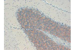 KCHIP Immunohistochemistry.