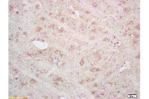 Formalin-fixed and paraffin embedded rat brain labeled with Rabbit Anti ARTS Polyclonal Antibody, Unconjugated (ABIN872659) at 1:200 followed by conjugation to the secondary antibody and DAB staining (Septin 4 anticorps  (AA 91-150))