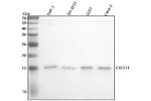 Western blot analysis of CXCL11 using anti-CXCL11 antibody (ABIN7604537).
