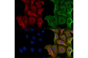 ABIN6264594 and ABIN6279749 staining Hela cells by IF/ICC. (RAB9B anticorps  (Internal Region))