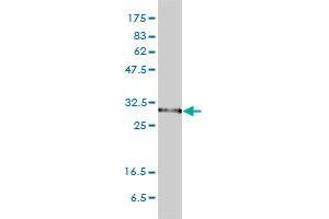 PSMA1 monoclonal antibody (M01), clone 1D9-1C7 Western Blot analysis of PSMA1 expression in HeLa .