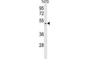 Western Blotting (WB) image for anti-BRISC and BRCA1 A Complex Member 1 (BABAM1) antibody (ABIN3003809) (BRISC and BRCA1 A Complex Member 1 (BABAM1) anticorps)