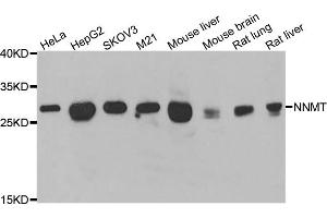 Western blot analysis of extracts of various cell lines, using NNMT antibody (ABIN5974021) at 1/1000 dilution. (NNMT anticorps)