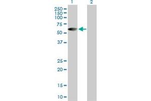 Western Blot analysis of HSFX1 expression in transfected 293T cell line by HSFX1 MaxPab polyclonal antibody. (HSFX1 anticorps  (AA 1-423))