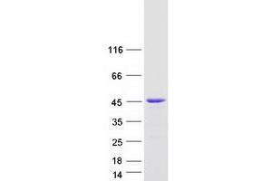 Validation with Western Blot