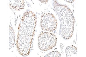 Immunohistochemistry (IHC) image for anti-Sp1 Transcription Factor (SP1) (AA 250-300) antibody (ABIN7795787)