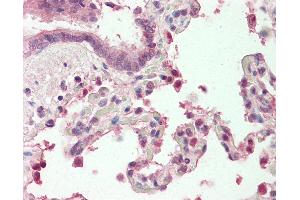 Human, Lung: Formalin-Fixed Paraffin-Embedded (FFPE). (MZF1 anticorps  (N-Term))