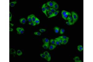 Immunofluorescence staining of HepG2 cells with ABIN7154296 at 1:133, counter-stained with DAPI.