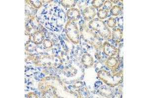 Immunohistochemistry of paraffin-embedded rat kidney using SMYD1 antibody (ABIN6128707, ABIN6148163, ABIN6148165 and ABIN6219496) at dilution of 1:200 (40x lens). (SMYD1 anticorps  (AA 1-350))