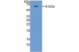 Western blot analysis of recombinant Human MR. (NR3C2 anticorps  (AA 739-984))