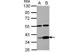WB Image Sample (30 ug of whole cell lysate) A: PC-3 B: U87-MG 10% SDS PAGE antibody diluted at 1:1000 (LUZP4 anticorps)