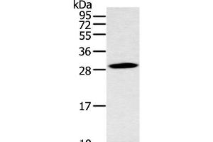 Western blot analysis of Mouse stomach tissue using YRDC Polyclonal Antibody at dilution of 1:400 (YRDC anticorps)