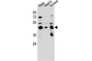 Western blot analysis of LRRC28 Antibody (C-term) in A549, HepG2 cell line and mouse heart tissue lysates (35ug/lane). (LRRC28 anticorps  (C-Term))