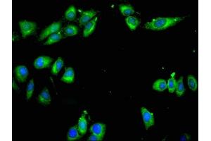 Immunofluorescent analysis of Hela cells using ABIN7143077 at dilution of 1:100 and Alexa Fluor 488-congugated AffiniPure Goat Anti-Rabbit IgG(H+L)