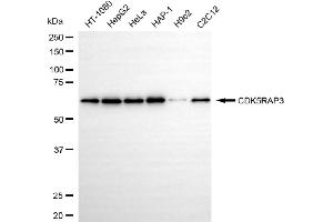 Western blotting analysis using CDK5RAP3 antibody (ABIN7797997).
