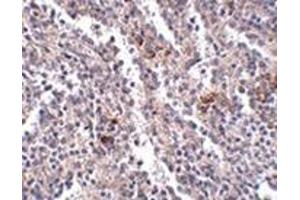 anti-Synaptophysin-Like 2 (SYPL2) (C-Term) antibody