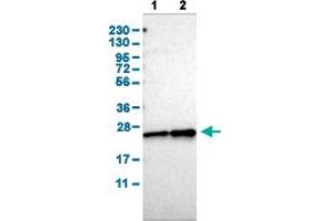 Western Blot analysis of (1) human cell line RT-4, and (2) human cell line U-251MG sp. (CBX5 anticorps  (AA 30-137))