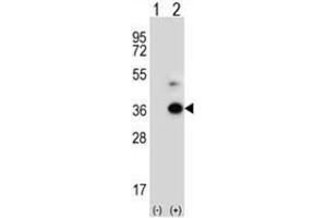 Western blot analysis of ANGPTL7 (arrow) using rabbit polyclonal ANGPTL7 Antibody (C-term) . (ANGPTL7 anticorps  (C-Term))