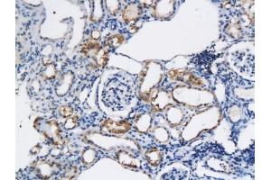 Formalin-fixed and paraffin embedded rat kidney labeled with Anti-CD59 Polyclonal Antibody, Unconjugated (ABIN732338) followed by conjugation to the secondary antibody and DAB staining
