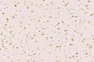 Immunohistochemistry analysis of paraffin-embedded rat substantia nigra using RanBP16 (ABIN7073901) at dilution of 1: 2000