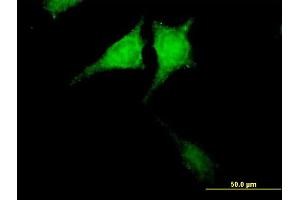Immunofluorescence of purified MaxPab antibody to CARD8 on HeLa cell. (CARD8 anticorps  (AA 1-392))