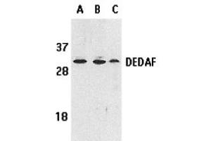 Western Blotting (WB) image for anti-RING1 and YY1 Binding Protein (RYBP) antibody (ABIN1031706) (RYBP anticorps)