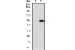 Western Blotting (WB) image for anti-Enhancer of Zeste Homolog 2 (EZH2) (AA 1-194) antibody (ABIN5944662) (EZH2 anticorps  (AA 1-194))