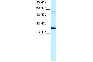 PARP1 antibody used at 5 ug/ml to detect target protein. (PARP1 anticorps)