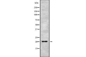 Western blot analysis of MED28 using MCF7 whole cell lysates (MED28 anticorps  (Internal Region))