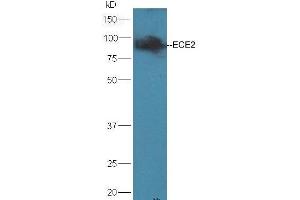 Mouse brain lysates probed with Rabbit Anti-ECE2 Polyclonal Antibody, Unconjugated (ABIN733958) at 1:300 overnight at 4 °C. (ECE2 anticorps  (AA 601-700))
