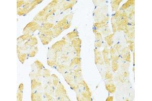Immunohistochemistry of paraffin-embedded Mouse heart using DDX3Y Polyclonal Antibody at dilution of 1:100 (40x lens). (DDX3Y anticorps)