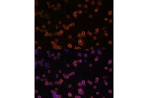 Immunofluorescence analysis of Raw264. (CD39 anticorps  (AA 1-180))
