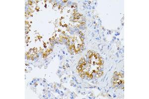 Immunohistochemistry of paraffin-embedded rat lung using EIF2B2 antibody (ABIN6132131, ABIN6140037, ABIN6140038 and ABIN6222805) at dilution of 1:100 (40x lens).