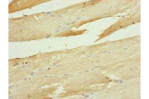 Immunohistochemistry of paraffin-embedded human skeletal muscle tissue using ABIN7149113 at dilution of 1:100 (UQCRC1 anticorps  (AA 1-63))