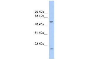 WB Suggested Anti-ZNF213 Antibody Titration:  0. (ZNF213 anticorps  (Middle Region))