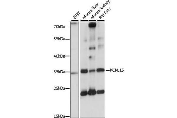 KCNJ15 antibody  (AA 221-375)