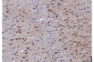 IHC analysis of LNPEP using anti-LNPEP antibody (ABIN7600279). (LNPEP anticorps  (AA 17-994))
