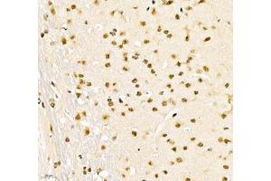 Immunohistochemistry of paraffin embedded mouse brain using PABPN1 (ABIN7075116) at dilution of 1:600 (400x lens) (PABPN1 anticorps)