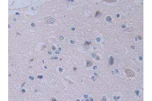 Detection of YARS in Human Cerebrum Tissue using Polyclonal Antibody to Tyrosyl tRNA Synthetase (YARS)