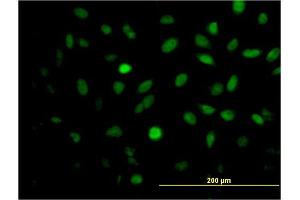 Immunofluorescence of monoclonal antibody to MEIS2 on HeLa cell. (MEIS2 anticorps  (AA 1-381))