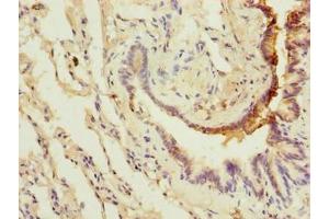 Immunohistochemistry of paraffin-embedded human lung tissue using ABIN7175622 at dilution of 1:100 (LRRC8E anticorps  (AA 353-630))