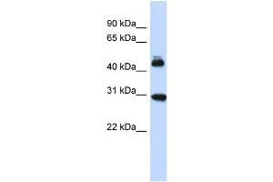 Host:  Rabbit  Target Name:  CBX4  Sample Type:  Fetal Brain lysates  Antibody Dilution:  1. (CBX4 anticorps  (Middle Region))