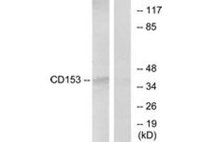Western blot analysis of extracts from RAW264. (TNFSF8 anticorps  (AA 71-120))