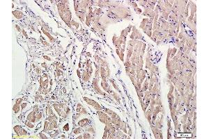 Formalin-fixed and paraffin embedded rat heart labeled with Anti-phospho-ROCK1(Thr455/Ser456) Polyclonal Antibody, Unconjugated (ABIN707771) at 1:200 followed by conjugation to the secondary antibody and DAB staining. (ROCK1 anticorps  (pSer456, pThr455))