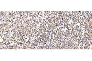 Immunohistochemistry of paraffin-embedded Human tonsil tissue using GNAI2 Polyclonal Antibody at dilution of 1:25(x200) (GNAI2 anticorps)