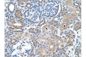 SARDH antibody was used for immunohistochemistry at a concentration of 4-8 ug/ml.