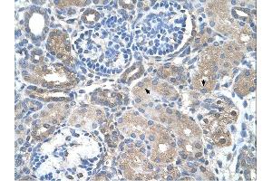 SARDH antibody was used for immunohistochemistry at a concentration of 4-8 ug/ml. (SARDH anticorps  (Middle Region))